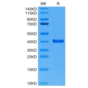 Mouse ANXA2 Protein , ANX-ME102 Ushelf