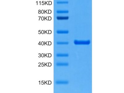 Mouse ANXA2 Protein , ANX-ME102 Ushelf