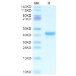 Mouse APOA5 Protein , APA-ME105