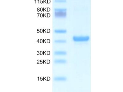 Mouse APOA5 Protein , APA-ME105 Ushelf
