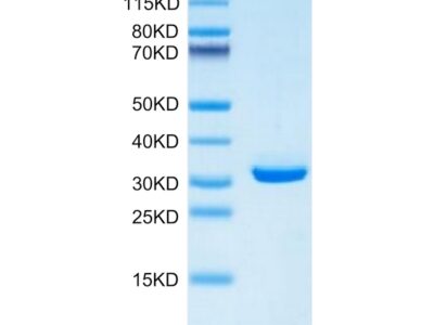 Mouse APOE/Apolipoprotein E Protein , APO-MM102 Ushelf