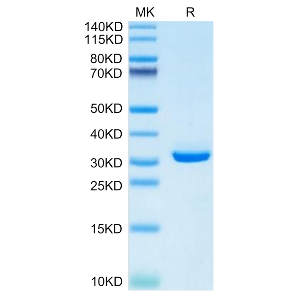 Mouse APOEApolipoprotein E Protein , APO-MM102 Mouse APOE/Apolipoprotein E Protein , APO-MM102 Ushelf