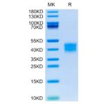 Mouse ASGR1 Protein , ASG-MM1R1