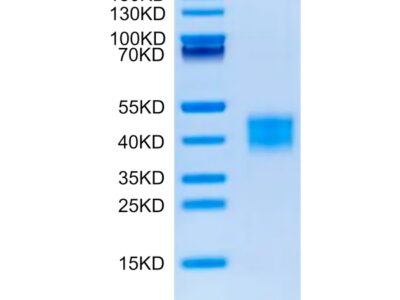 Mouse ASGR1 Protein , ASG-MM1R1 Ushelf