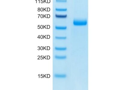 Mouse Adiponectin/Acrp30 Protein, ADI-MM201 Ushelf