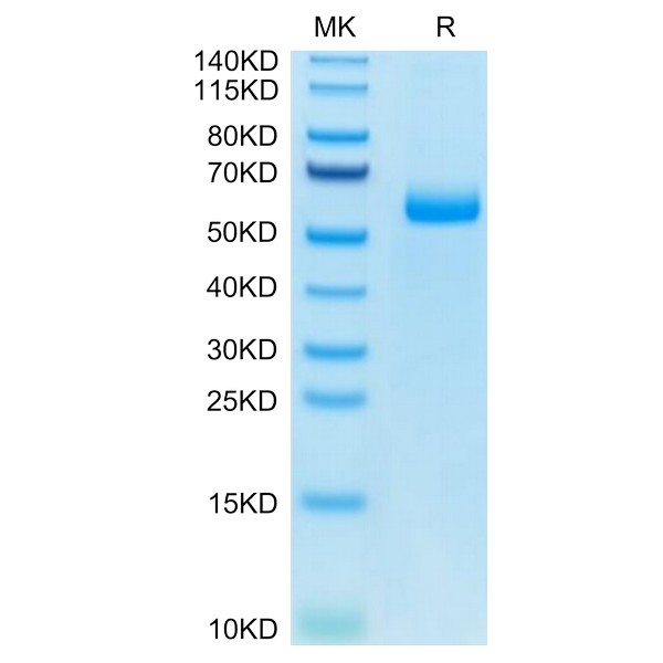 Mouse AdiponectinAcrp30 Protein, ADI-MM201 Mouse Adiponectin/Acrp30 Protein, ADI-MM201 Ushelf