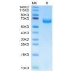 Mouse Alkaline phosphatase (Intestinal type) ALPI Protein , APE-MM101