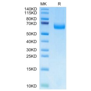 Mouse Alkaline phosphatase (Intestinal type) / ALPI Protein , APE-MM101 Ushelf