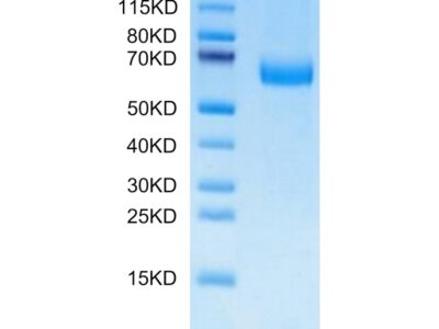 Mouse Alkaline phosphatase (Intestinal type) / ALPI Protein , APE-MM101 Ushelf