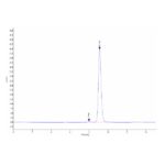 Mouse B2Mbeta 2-Microglobulin Protein , B2M-MM201
