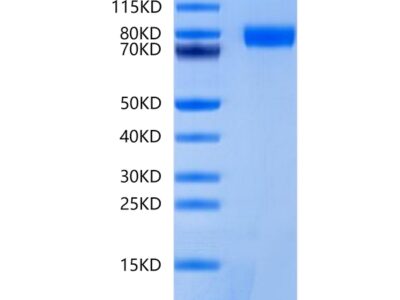 Mouse BCHE/Butyrylcholinesterase Protein , BCE-MM101 Ushelf