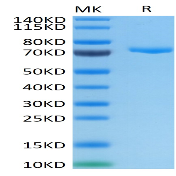 Human Nectin-4 Protein (NEC-HM204)