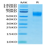 Human Nectin-1/PVRL1/CD111 Protein (NEC-HM401)