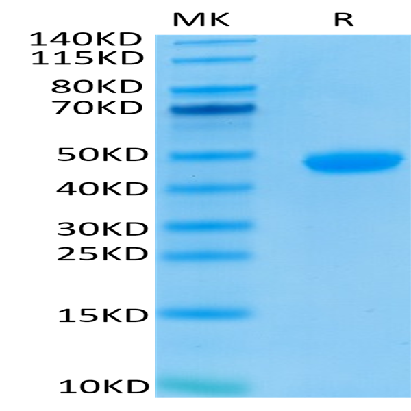 Biotinylated Human Nectin-4 Protein (NEC-HM404B)