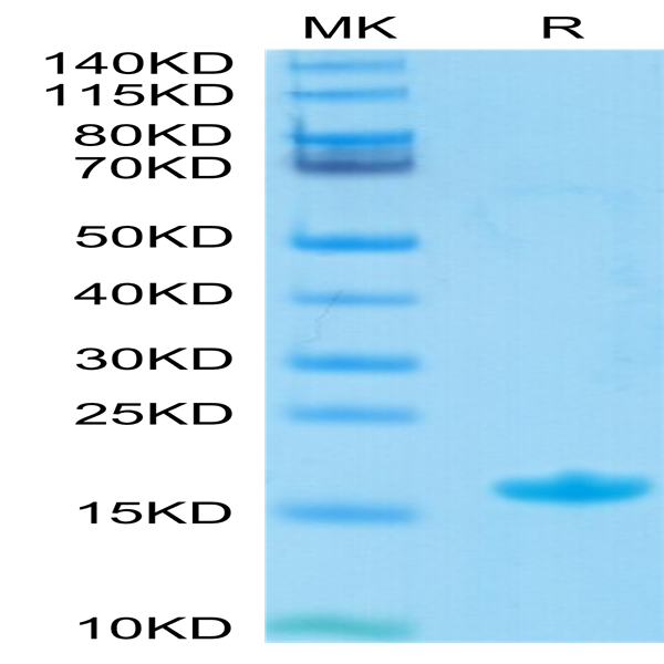 Biotinylated Human Nectin-4 Protein IgV Domain (NEC-HM414B)