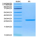 Human NGAL/Lipocalin-2 Protein (NGL-HM102)