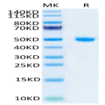 Human NGAL/Lipocalin-2 Protein (NGL-HM201)