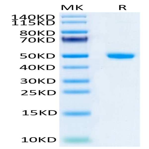 Human NGAL/Lipocalin-2 Protein (NGL-HM201)