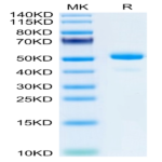 Mouse NGAL/Lipocalin-2 Protein (NGL-MM201)