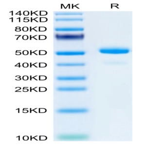 Mouse NGAL/Lipocalin-2 Protein (NGL-MM201)