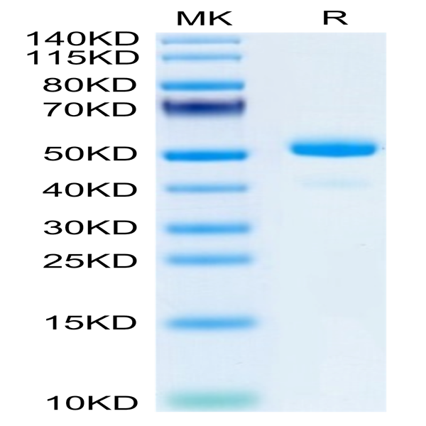 Mouse NGAL/Lipocalin-2 Protein (NGL-MM201)