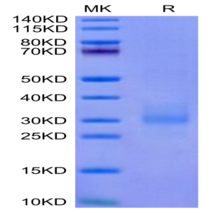 Cynomolgus NKG2A&CD94 Protein (NKC-CM194)
