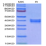 Cynomolgus NKG2C&CD94 Protein (NKC-CM1C4)