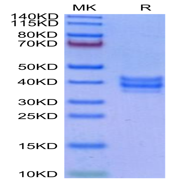 Cynomolgus NKG2C&CD94 Protein (NKC-CM1C4)