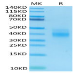 Human NKG2A&CD94 Protein (NKC-HM495)
