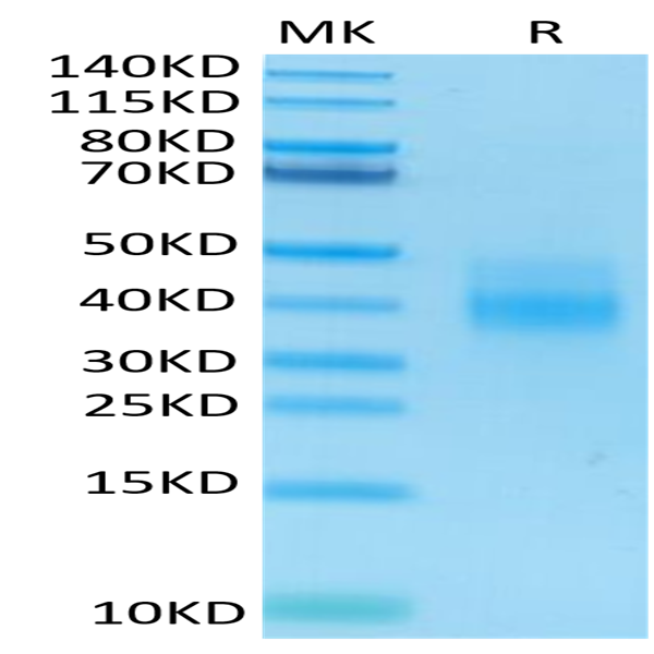 Human NKG2A&CD94 Protein (NKC-HM495)