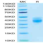 Biotinylated Human NKG2A&CD94 Protein (NKC-HM495B)