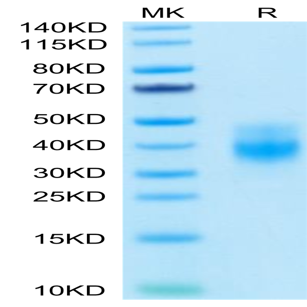 Biotinylated Human NKG2A&CD94 Protein (NKC-HM495B)