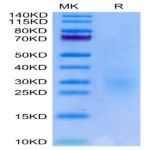 Biotinylated Human NKG2C&CD94 Protein (NKC-HM696B)