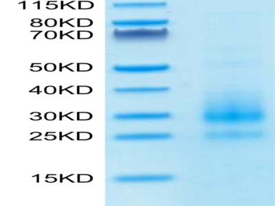 Cynomolgus NKG2C/CD159c Protein (NKG-CM12C)