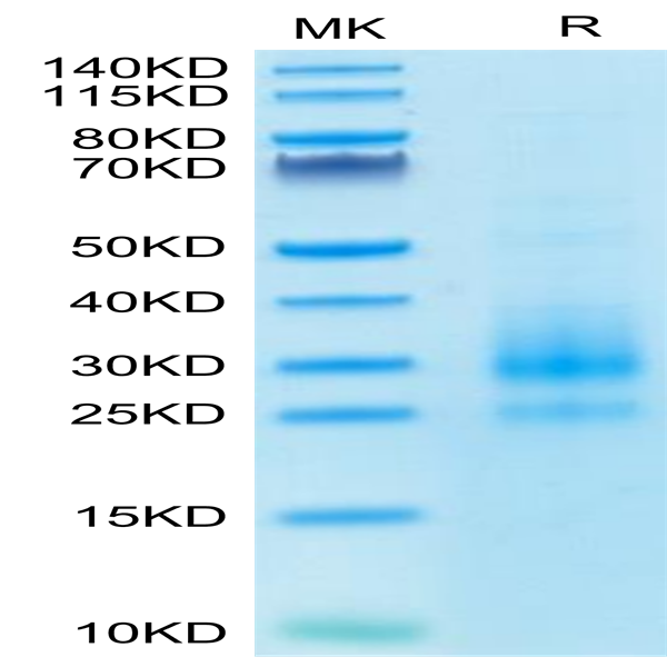 Cynomolgus NKG2C/CD159c Protein (NKG-CM12C) Cynomolgus NKG2C/CD159c Protein (NKG-CM12C)