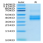 Human NKG2A/CD159a Protein (NKG-HM410)