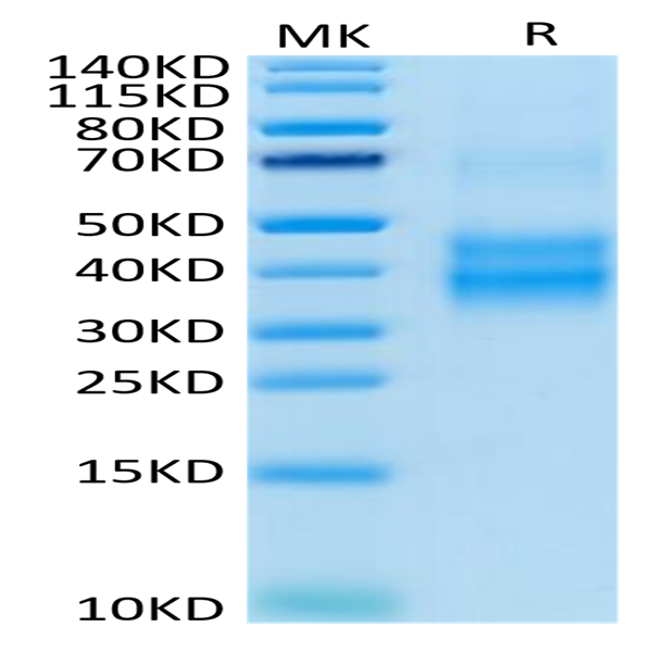 Human NKG2A/CD159a Protein (NKG-HM410)