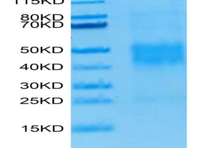 Human NKG2C/CD159c Protein (NKG-HM42C)