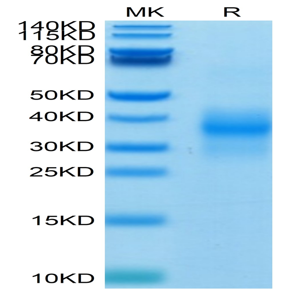 Biotinylated Human NKG2D/CD314 Protein (NKG-HM42DB)