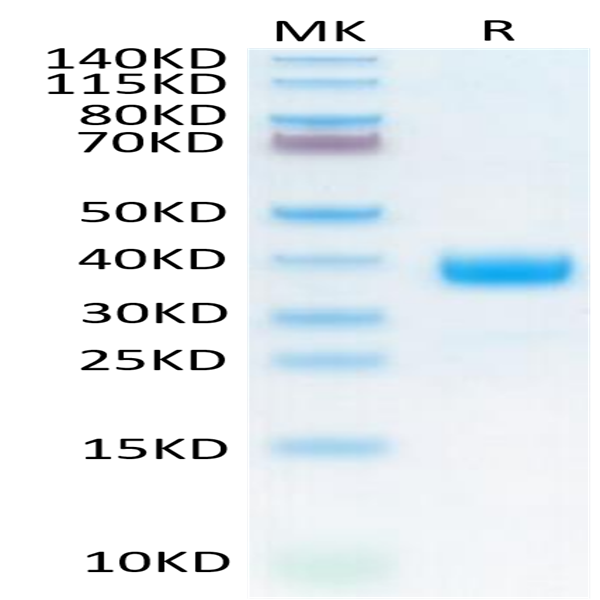 Cynomolgus NKp46/NCR1/CD335 Protein (NKP-CM146)