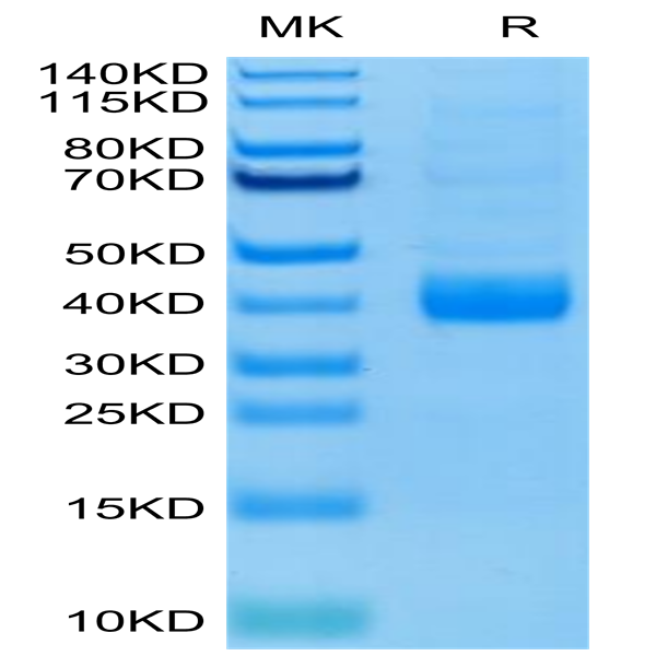 Biotinylated Human NKp46/NCR1/CD335 Protein (Primary Amine Labeling) (NKP-HM146B)