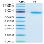 Human NKp46/NCR1/CD335 Protein (NKP-HM246)