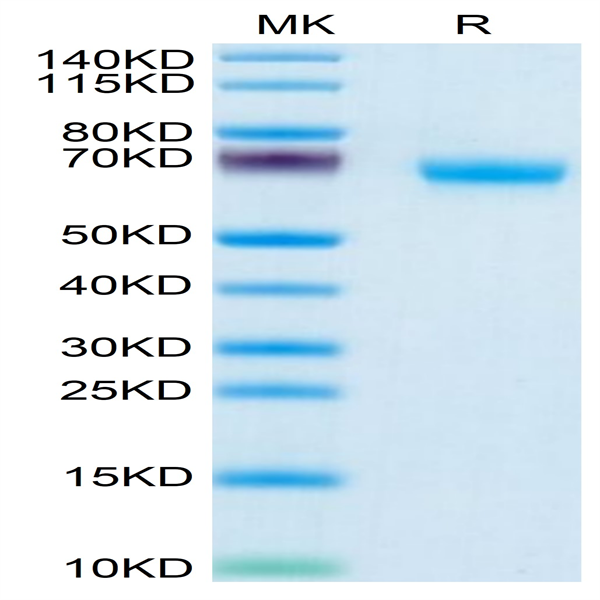 Human NKp46/NCR1/CD335 Protein (NKP-HM246)