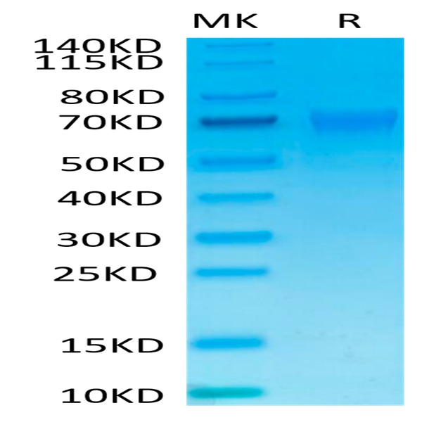 Human NKp46/NCR1/CD335 Protein (NKP-HM346)