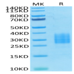 Biotinylated Human NKp30/NCR3/CD337 Protein (NKP-HM430B)