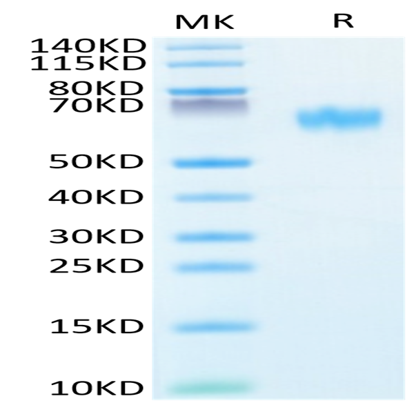 Human NOGOR Protein (NOG-HM101)