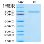 Human Notch 3 Protein (NOT-HM203)