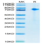 Biotinylated Human Notch 1 Protein (NOT-HM401B)