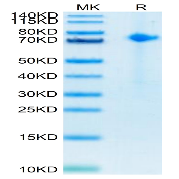 Biotinylated Human Notch 1 Protein (NOT-HM401B)