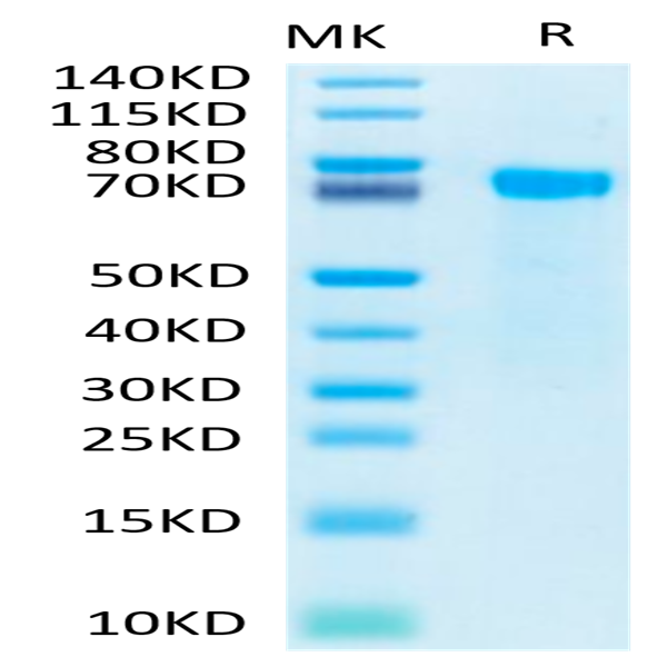 Biotinylated Human Notch 2 Protein (NOT-HM402B)